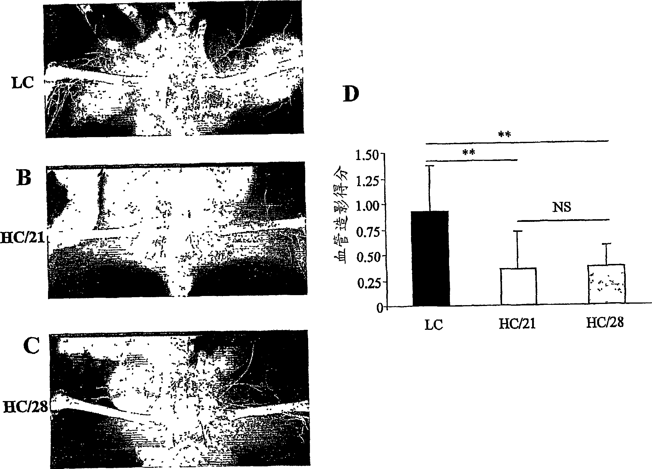 Plasmid encoding fibroblast growth factor for the treatment of hypercholesterolemia or diabetes associated angiogenic defects