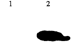 Expression and purification methods of fusion protein containing recombinant human fibroblast growth factor 21