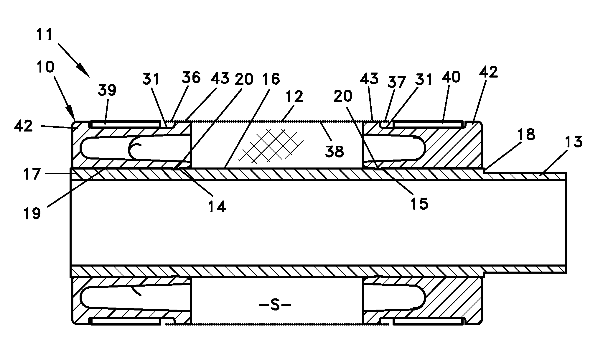 Snap-lock bushing for prepacked screens