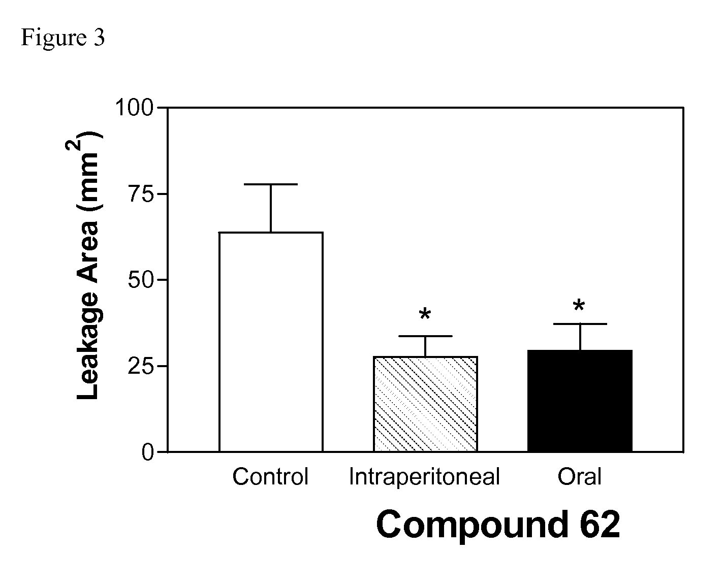 Sphingosine kinase inhibitors