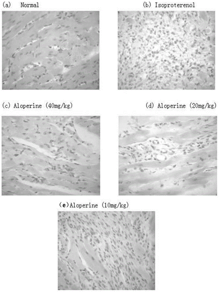 Application of aloperine serving as drug for treating myocardial hypertrophy