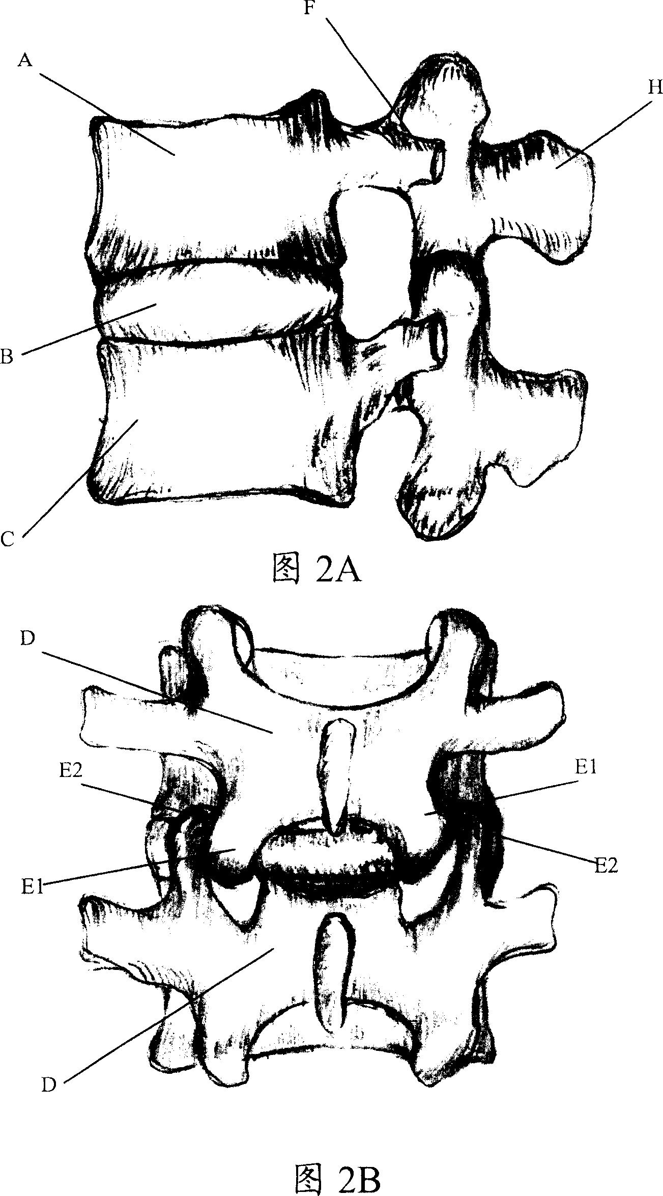 Coupling full intervertebral joints system