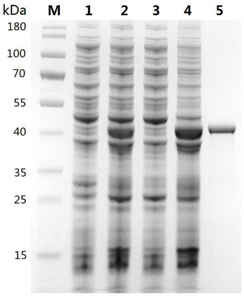 A recombinant fusion protein of Schistosoma aegypti shsap and its application in the immunodiagnosis of schistosomiasis