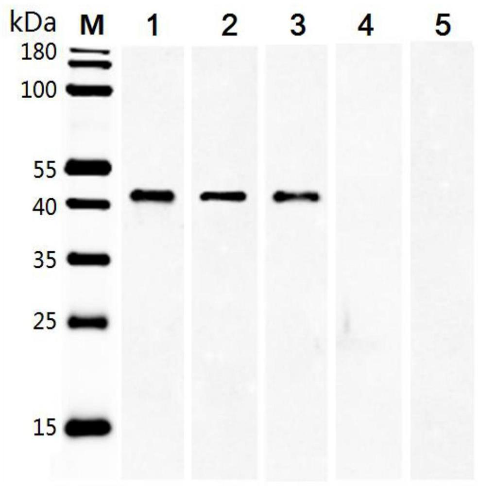 A recombinant fusion protein of Schistosoma aegypti shsap and its application in the immunodiagnosis of schistosomiasis