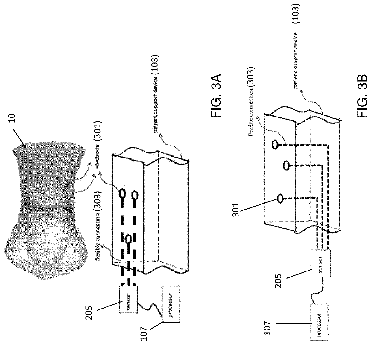 Systems and methods of body motion management during non-invasive imaging and treatment procedures