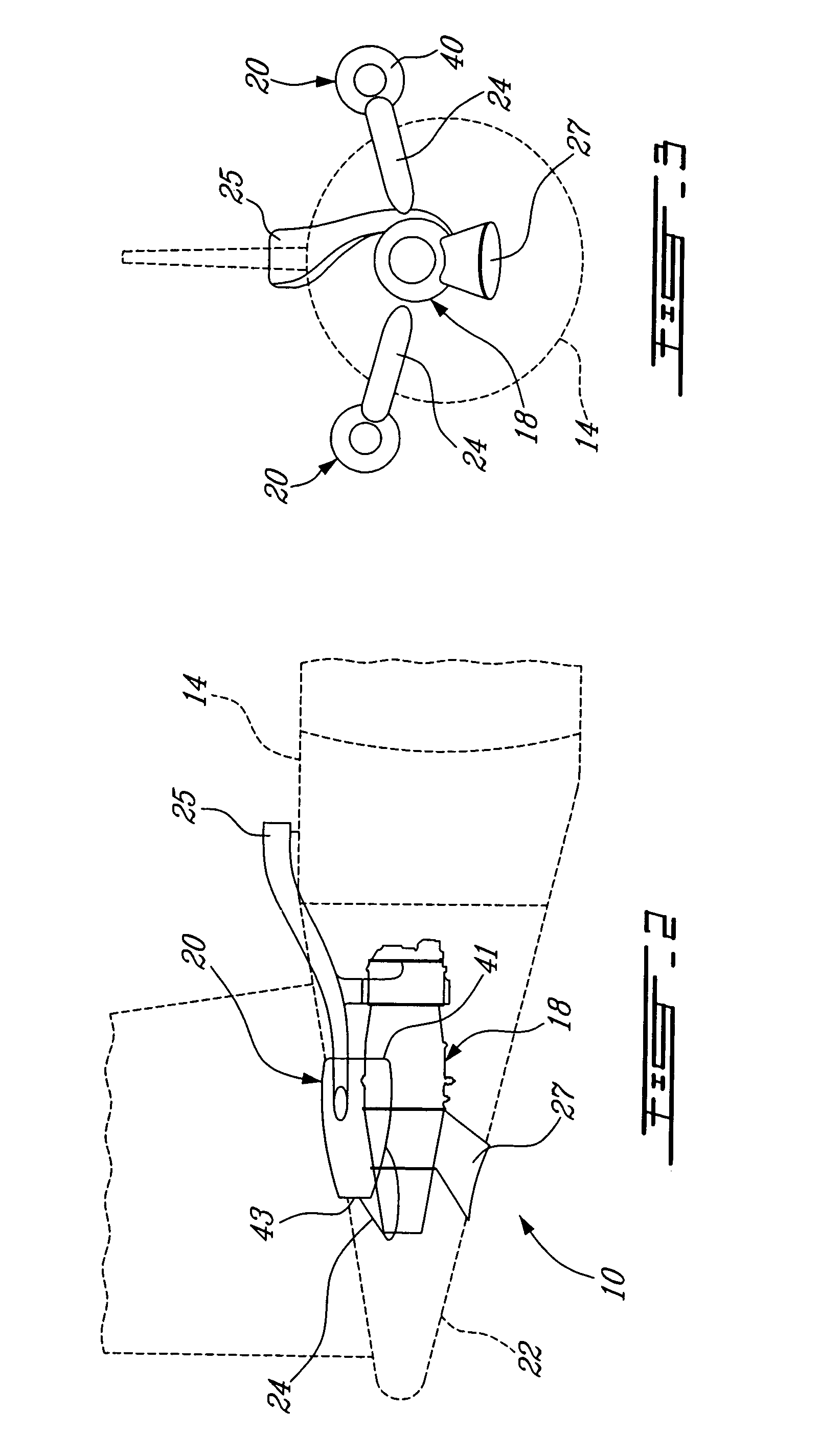 Aircraft propulsion system