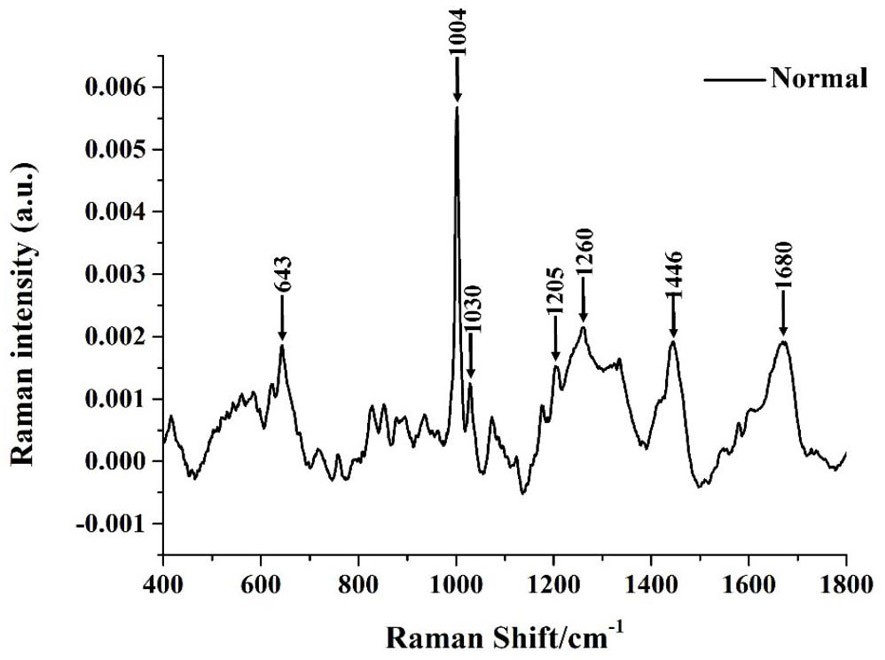 SERS Detection Method Based on Hydroxyapatite Nanoparticle Adsorbed Protein