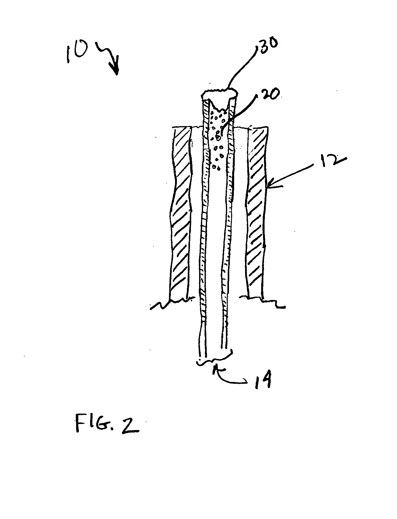 Radio-opaque hemostatic agents and devices and methods for the delivery thereof