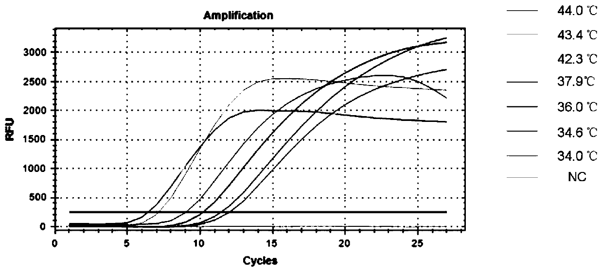 Real-time recombinase-mediated isothermal amplification nucleic acid kit for rapid detection of toxoplasma gondii and application thereof