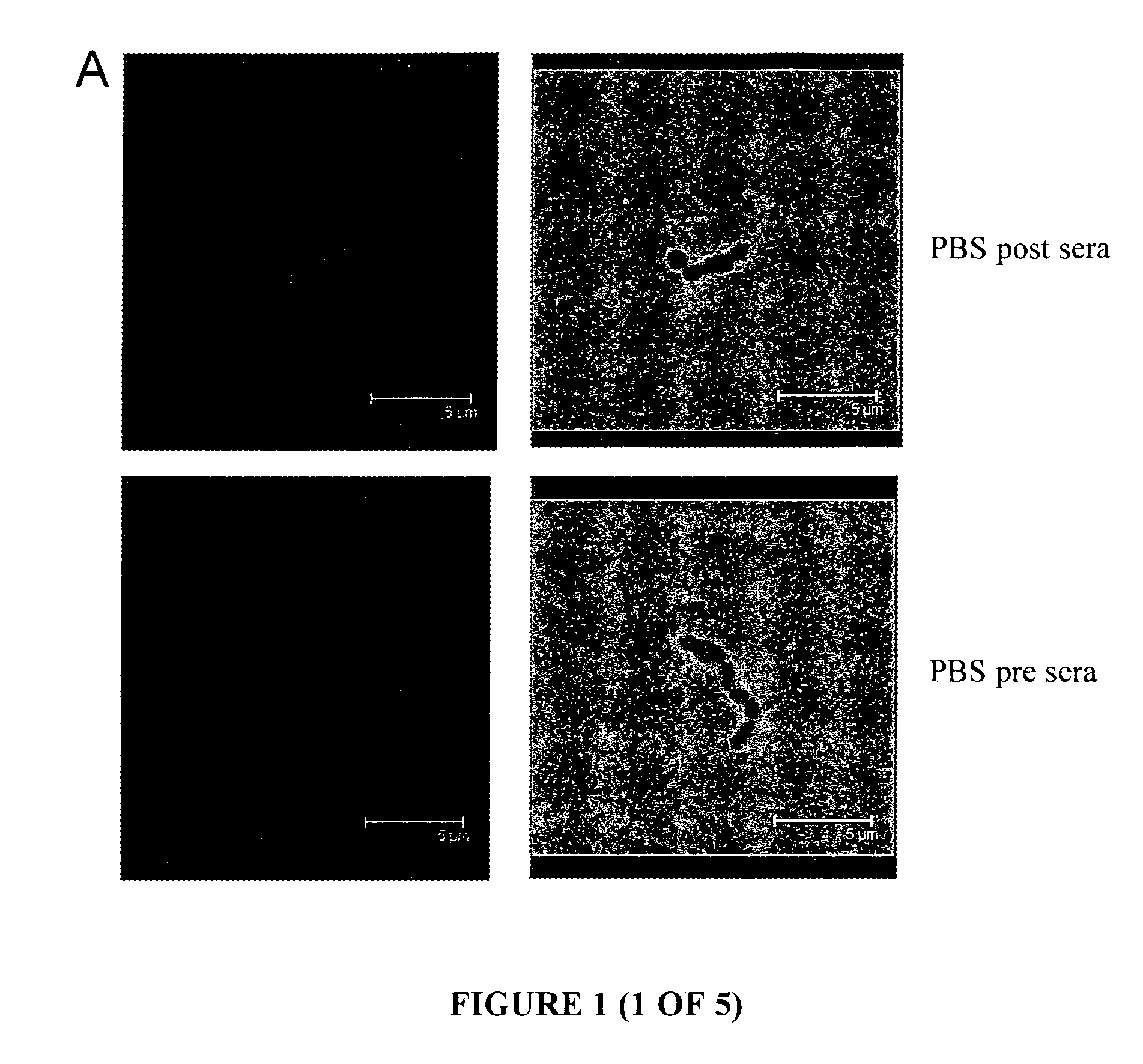 Group A Streptococcus Pharmaceutical Compositions and Methods Thereof