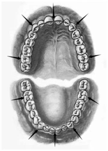 Intelligent design method of digital model for oral digital impression instrument