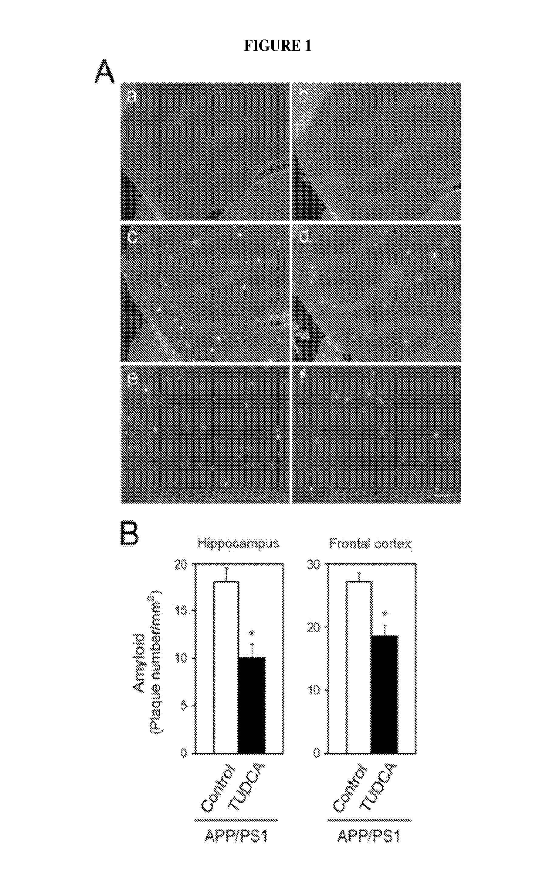 Tauroursodeoxycholic acid attentuates or abolishes formation and deposition of amyloid-b peptide