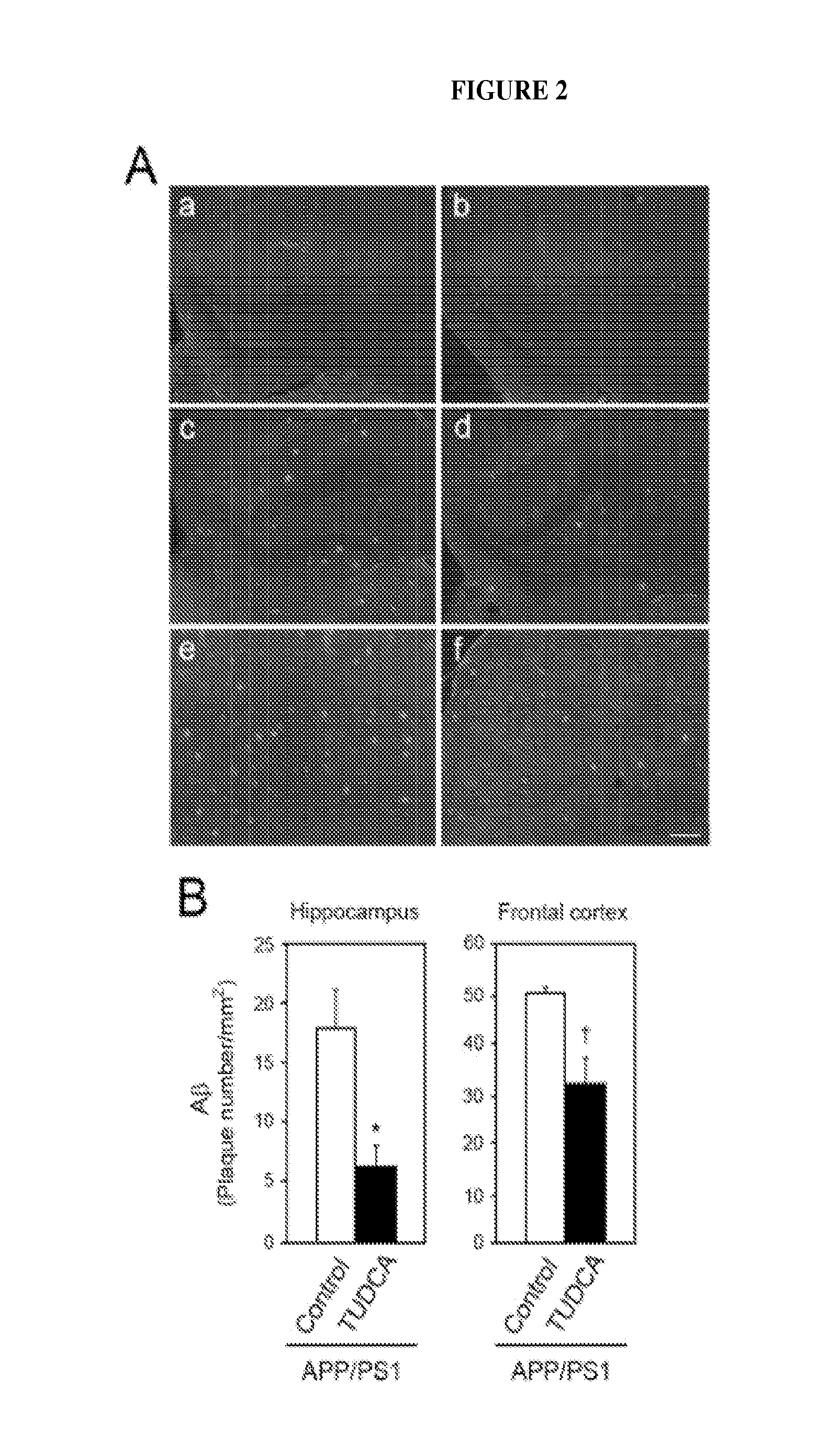 Tauroursodeoxycholic acid attentuates or abolishes formation and deposition of amyloid-b peptide