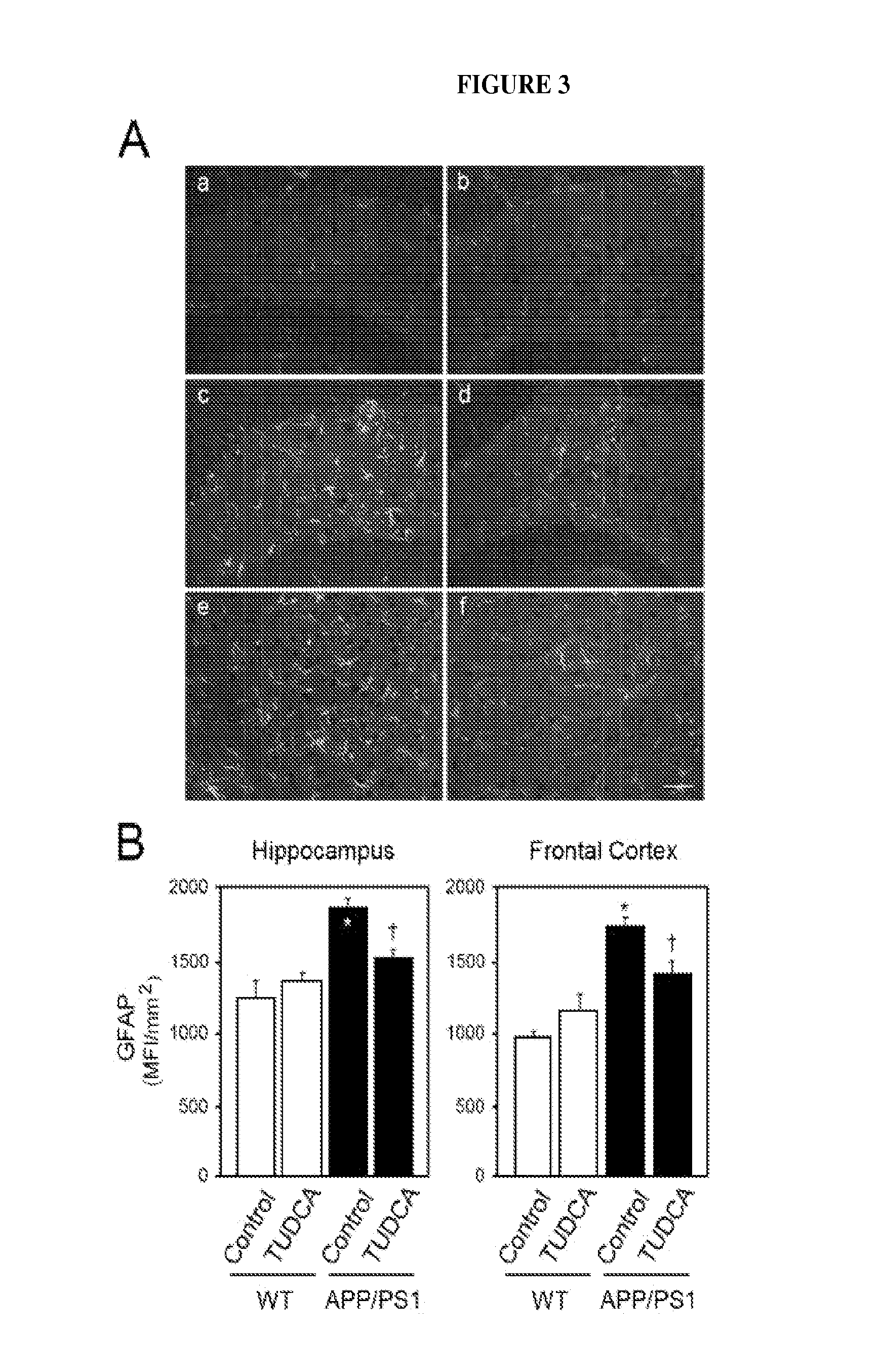 Tauroursodeoxycholic acid attentuates or abolishes formation and deposition of amyloid-b peptide