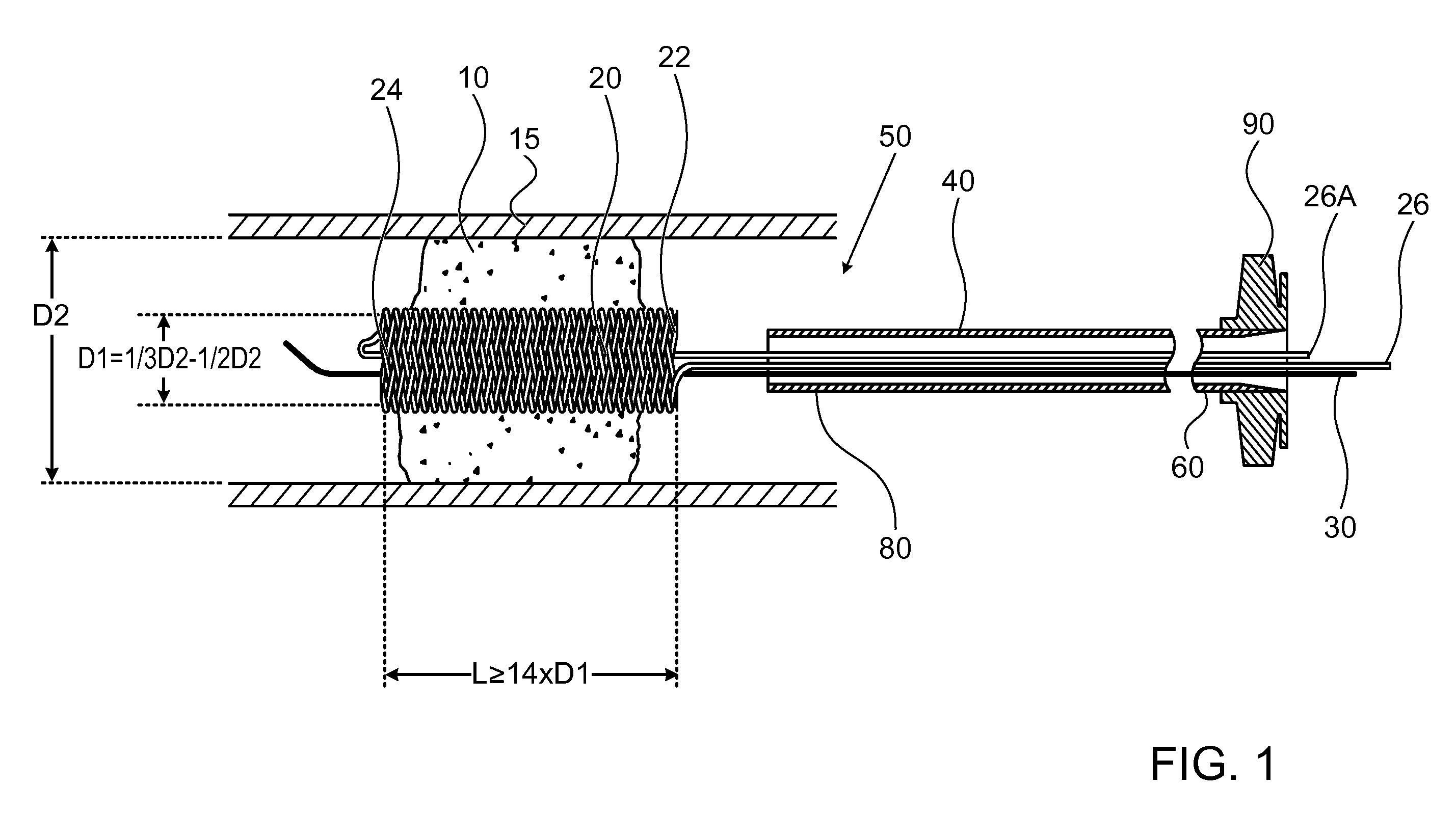 Method and apparatus for allowing blood flow through an occluded vessel