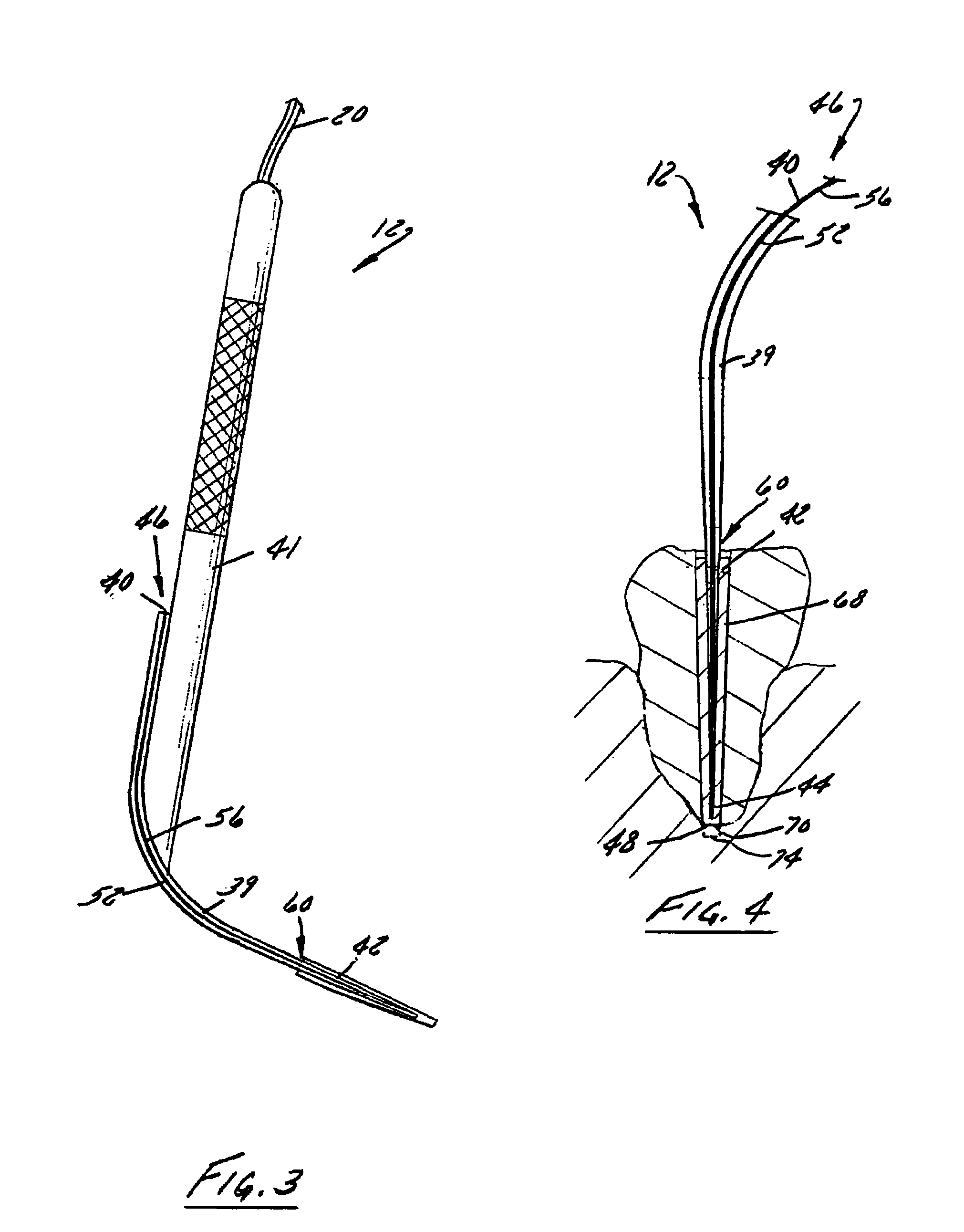 Device and method for in canal gutta-percha heating and condensation