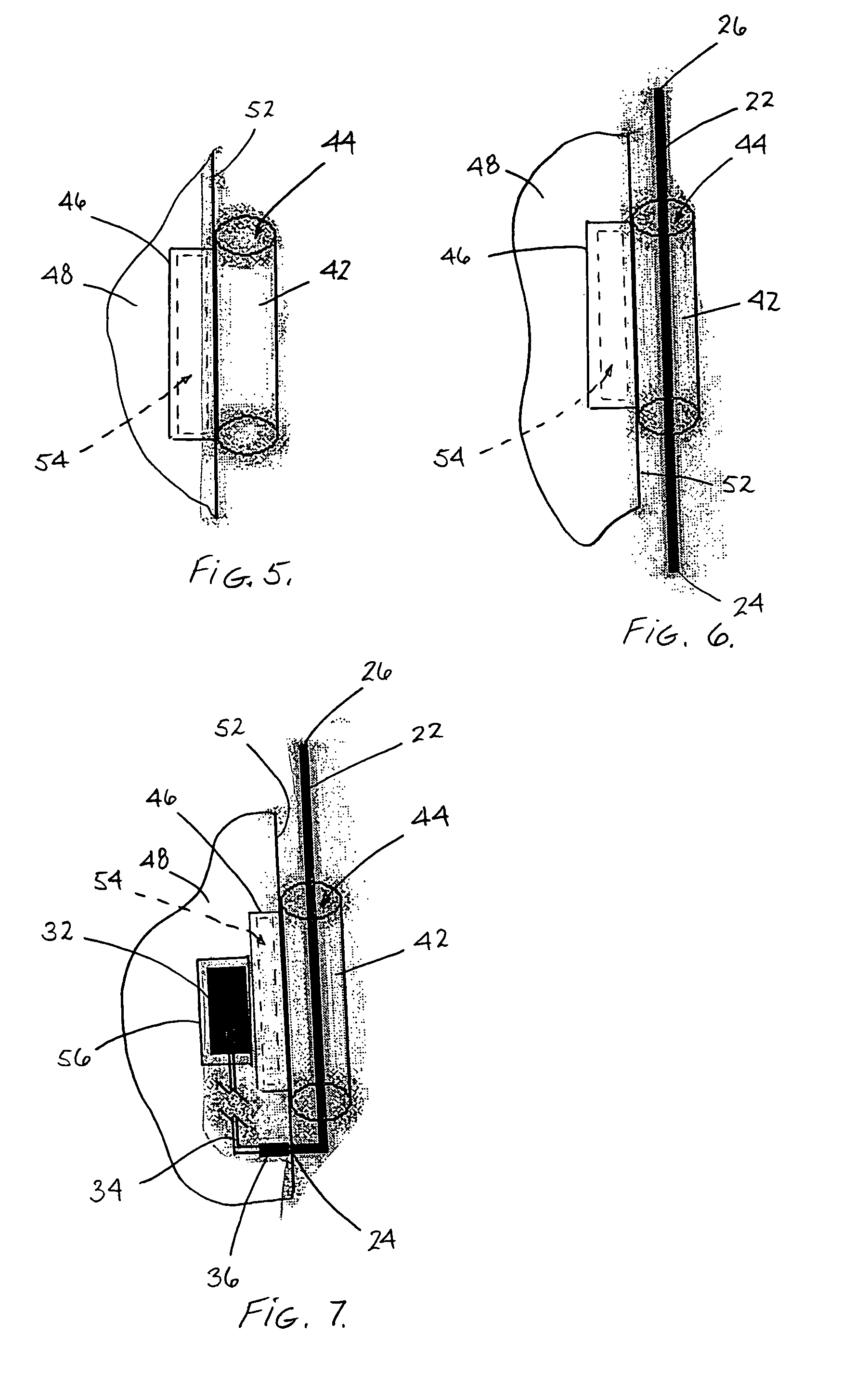 Method and apparatus for adding light transmission to an article of clothing