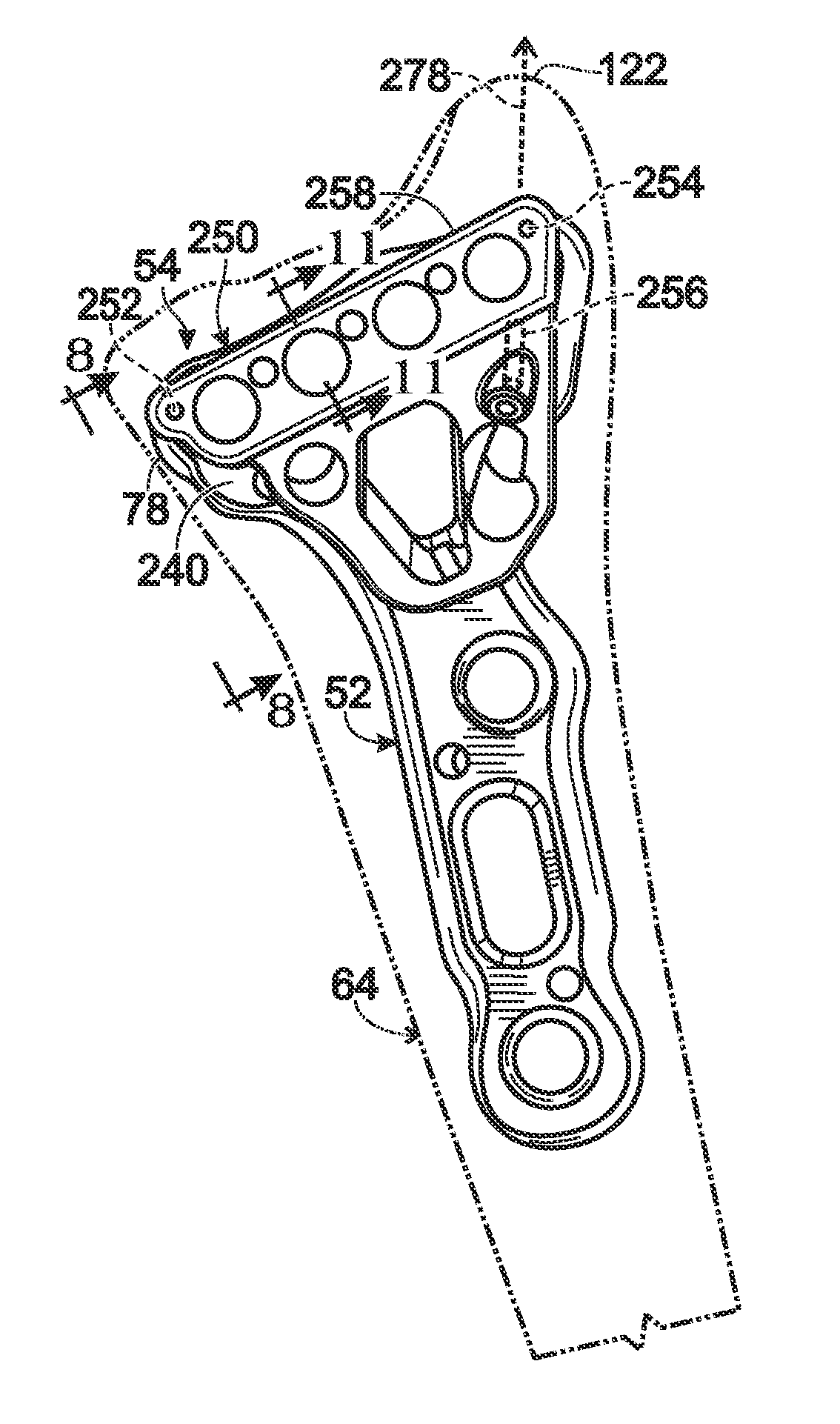 Handle assembly having a radiopaque region to facilitate positioning a bone plate on bone