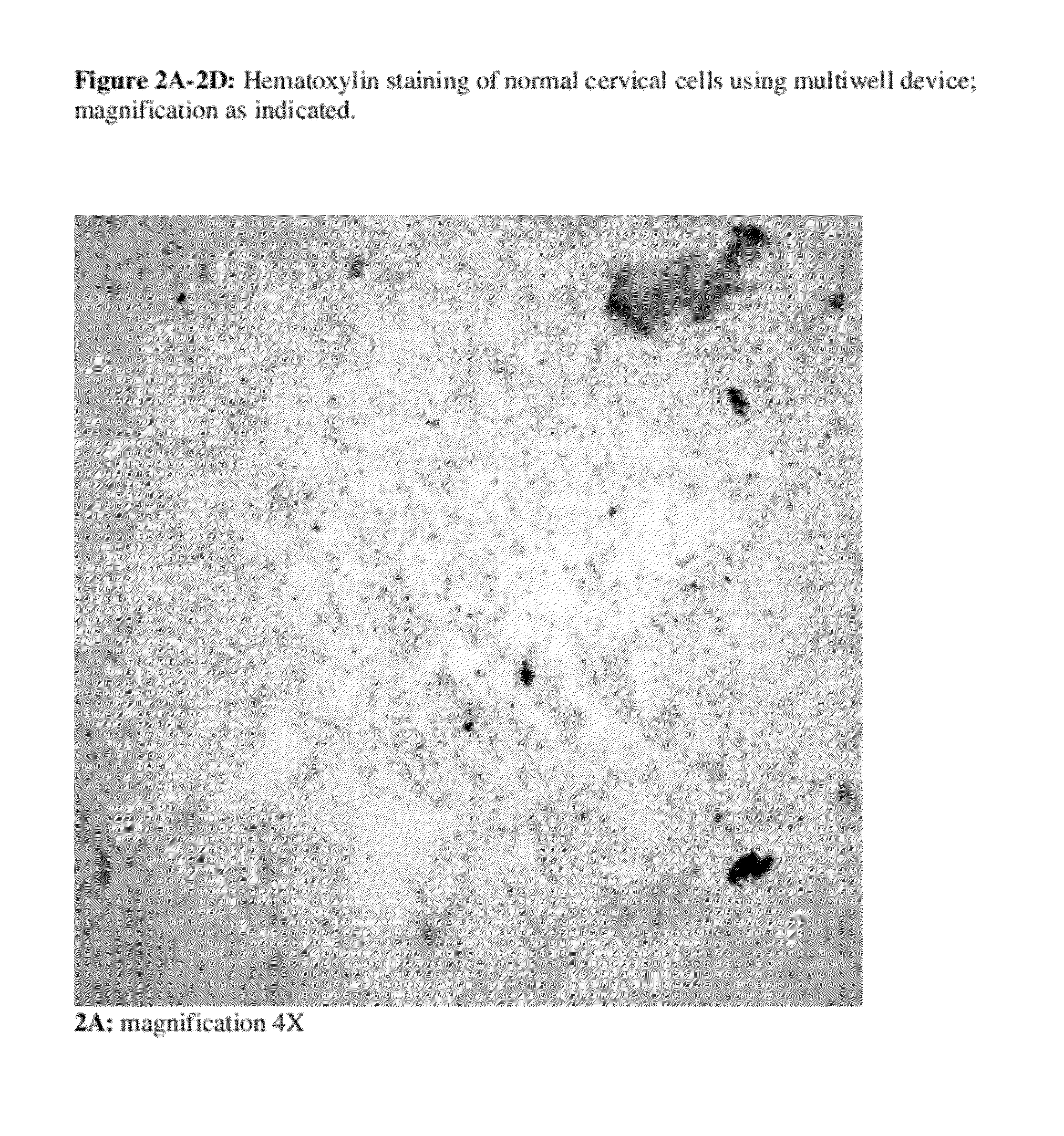 Device and Methods for the Detection of Cervical Disease