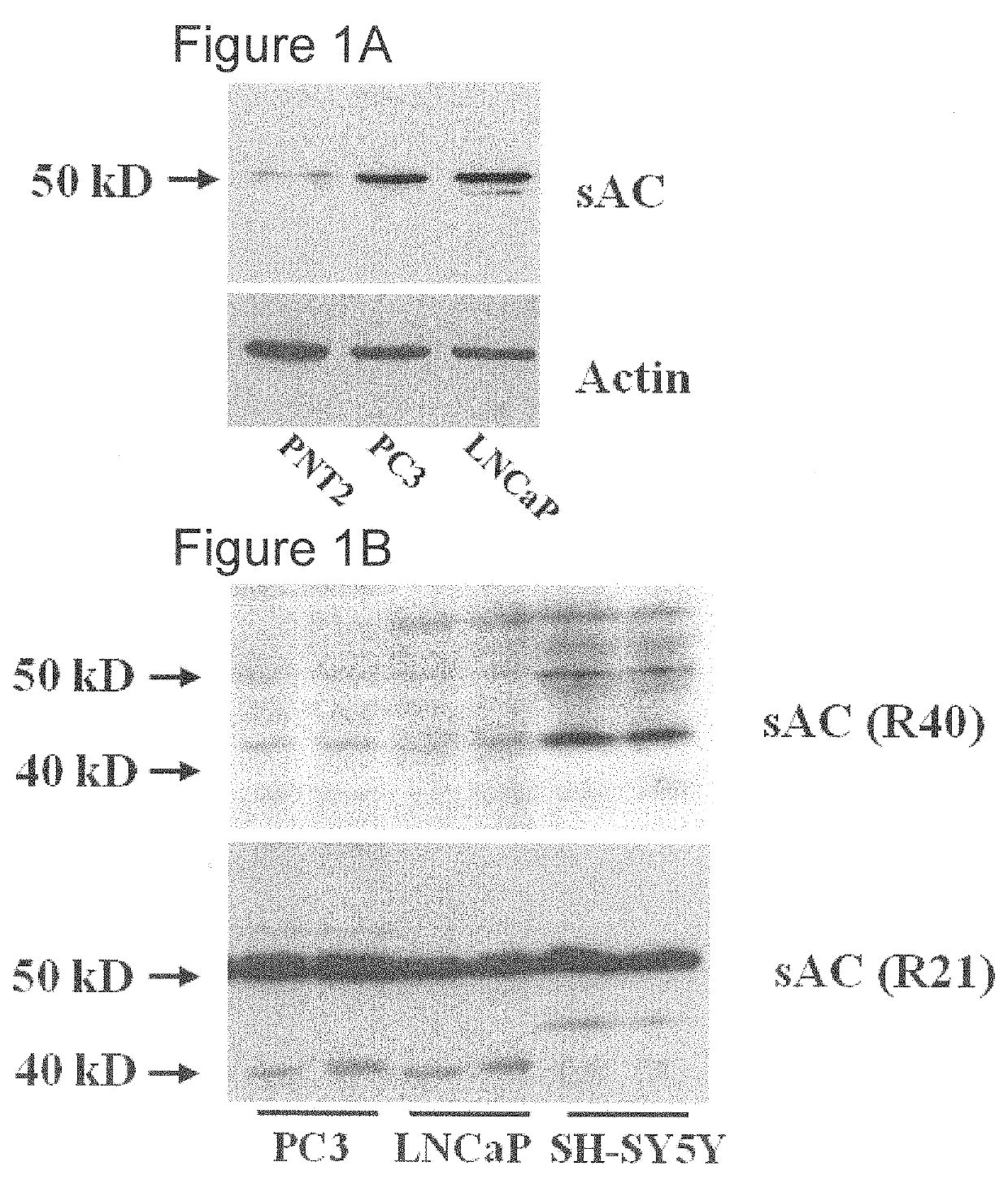 Methods for diagnosing and treating prostate cancer