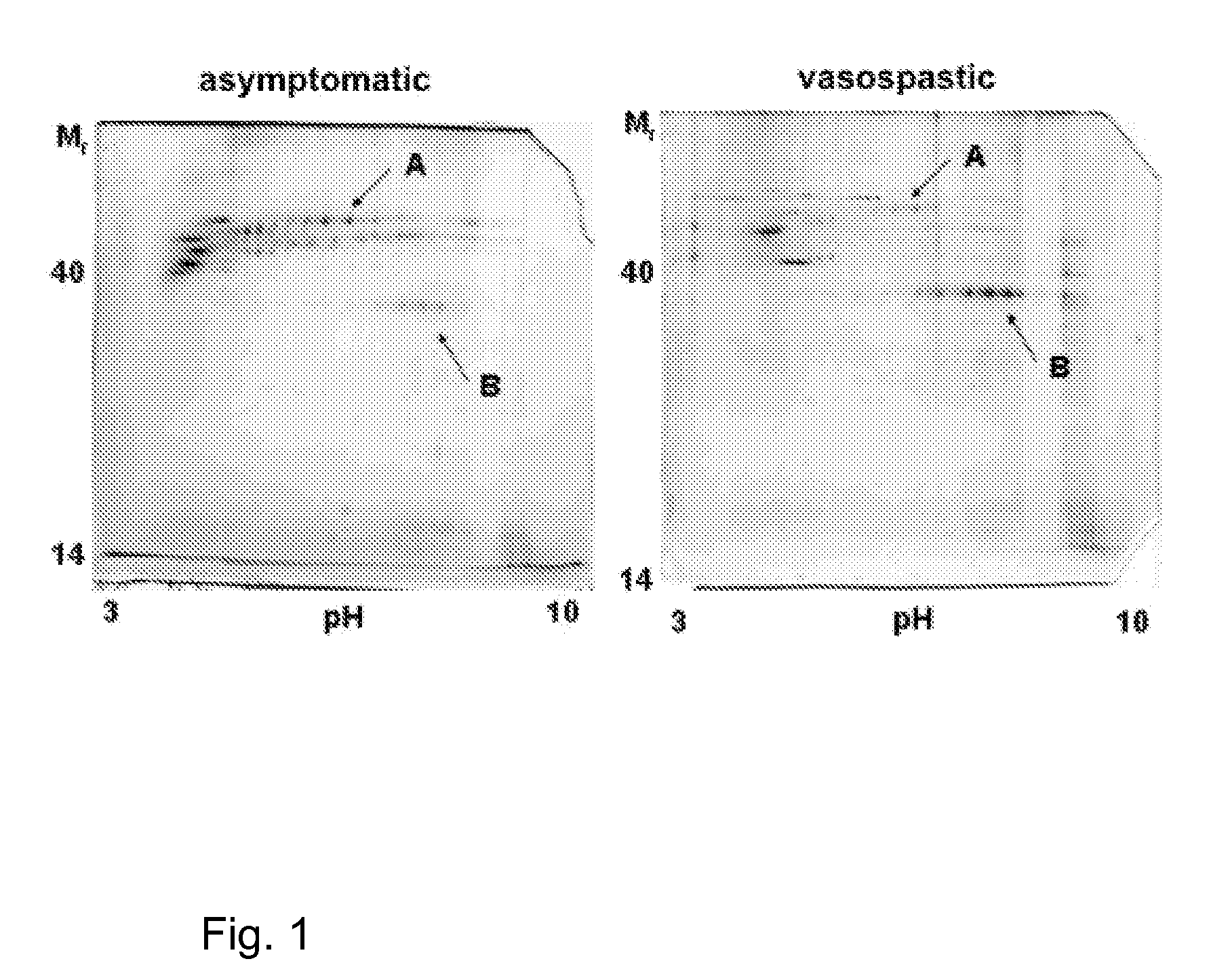 Screening Method for the Early Diagnosis of Cerebral Vasospasm