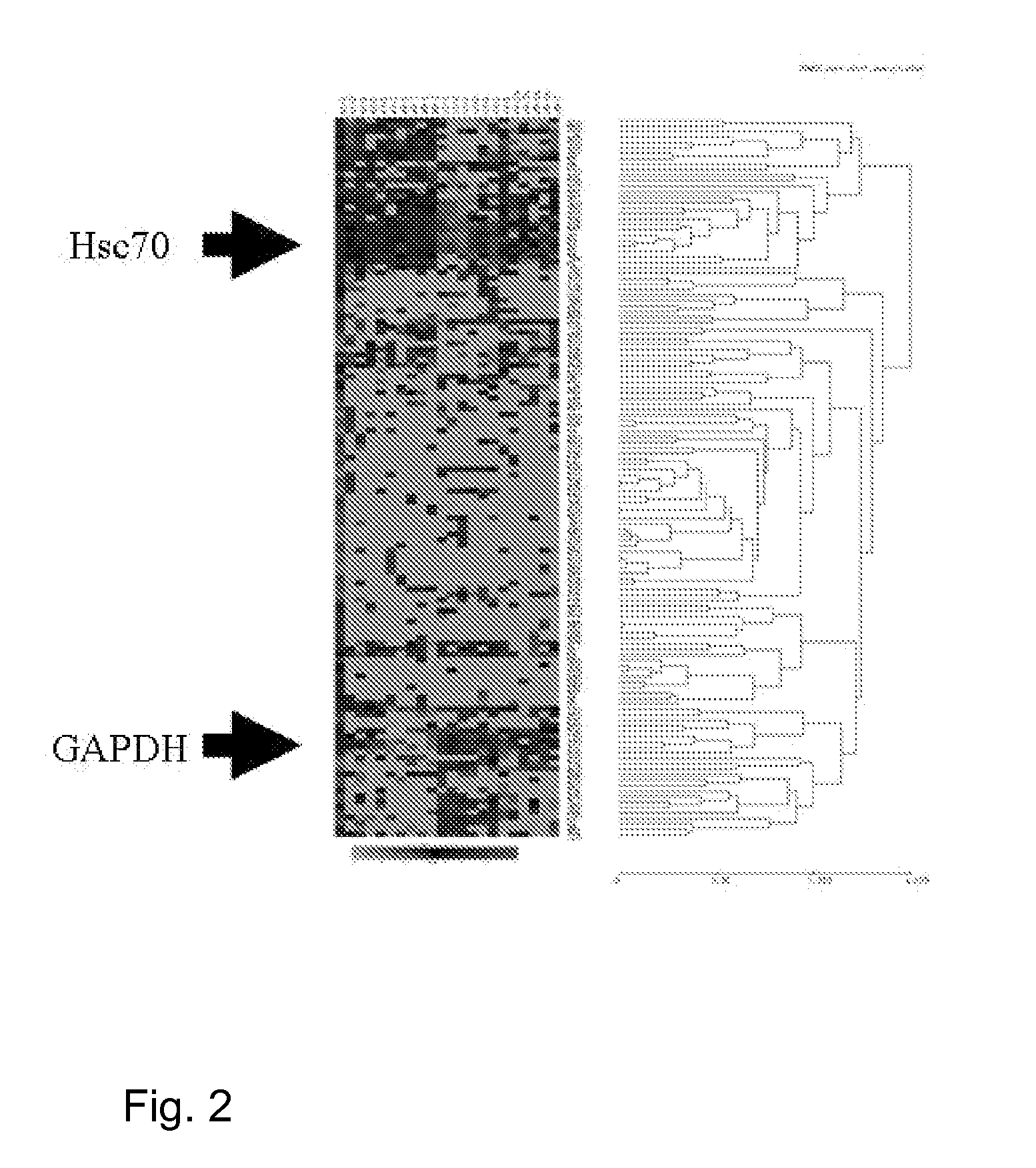 Screening Method for the Early Diagnosis of Cerebral Vasospasm