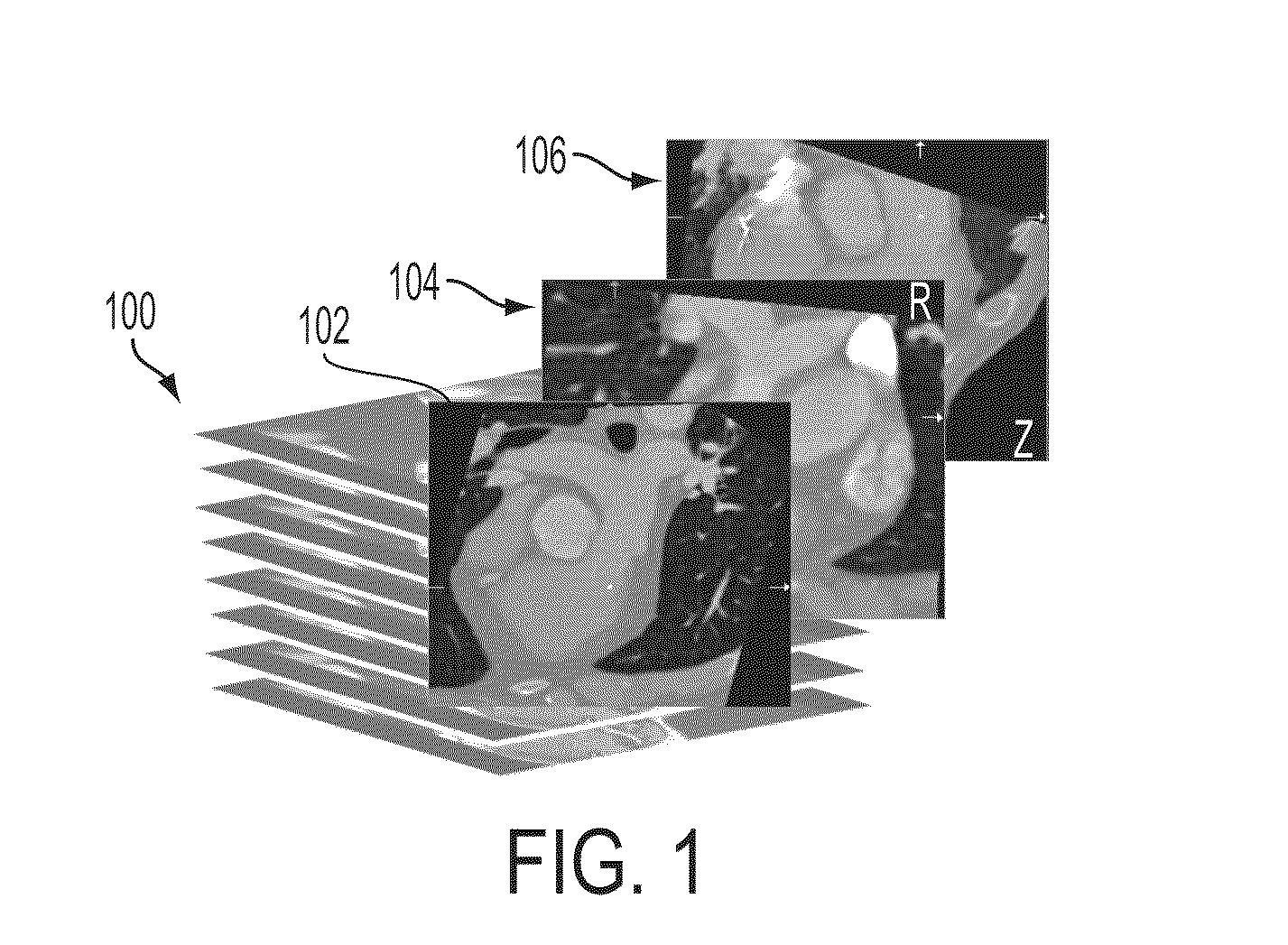 Method and system for dynamic pulmonary trunk modeling and intervention planning