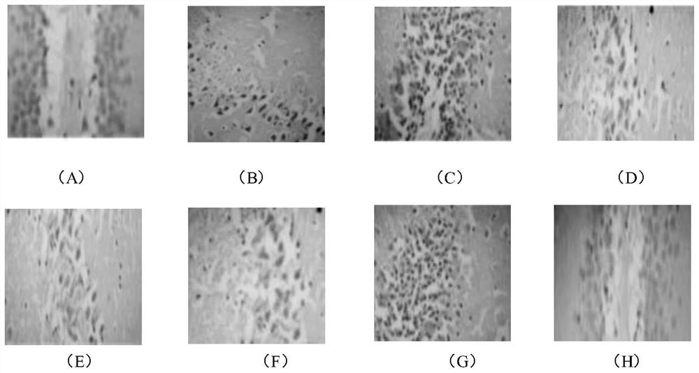 A traditional Chinese medicine composition for treating Alzheimer's disease and its preparation method and application