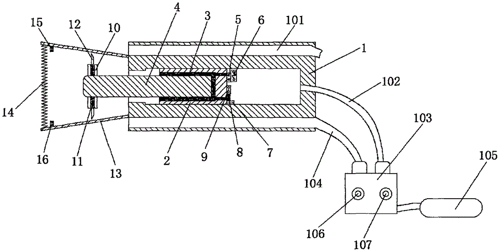 Multi-stage inching circulating plaque removal device for department of cardiology