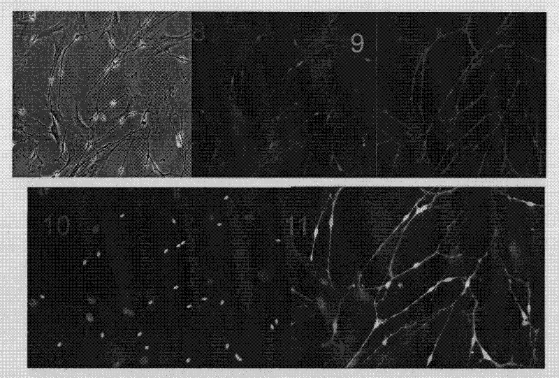 Method for isolating and purifying schwann cells from adipose tissue