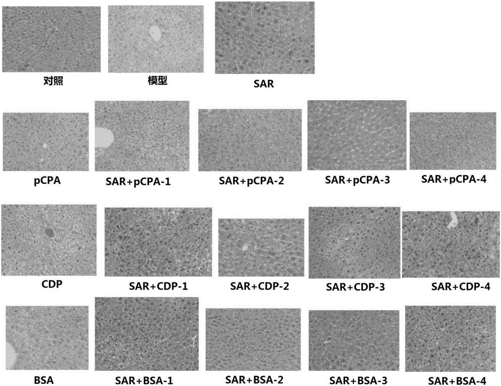 Application of medicine compositions with sarpogrelate to treating or preventing fatty livers, liver fibrosis and/or liver injury