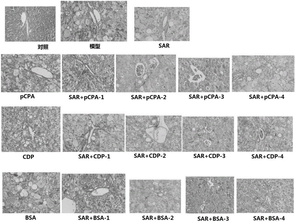 Application of medicine compositions with sarpogrelate to treating or preventing fatty livers, liver fibrosis and/or liver injury