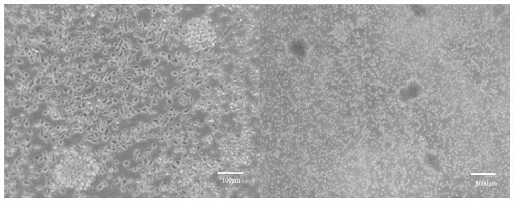 Exosome sorting method for NK cell activation stage