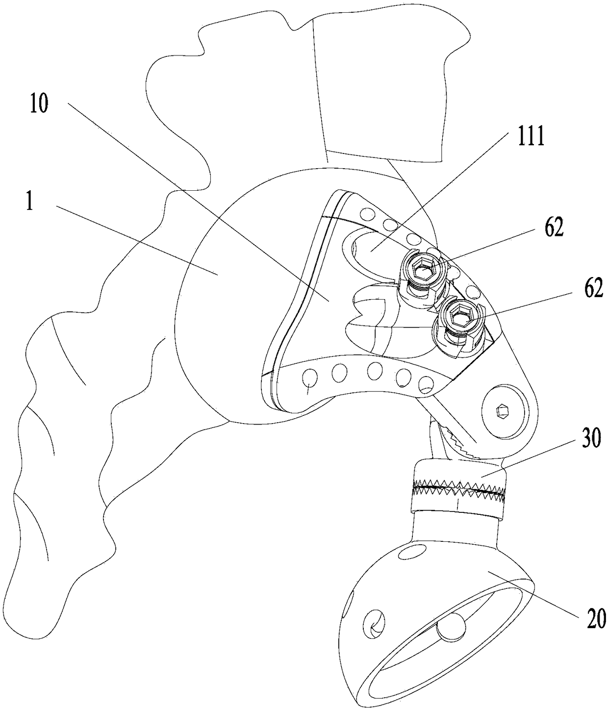 hip prosthesis