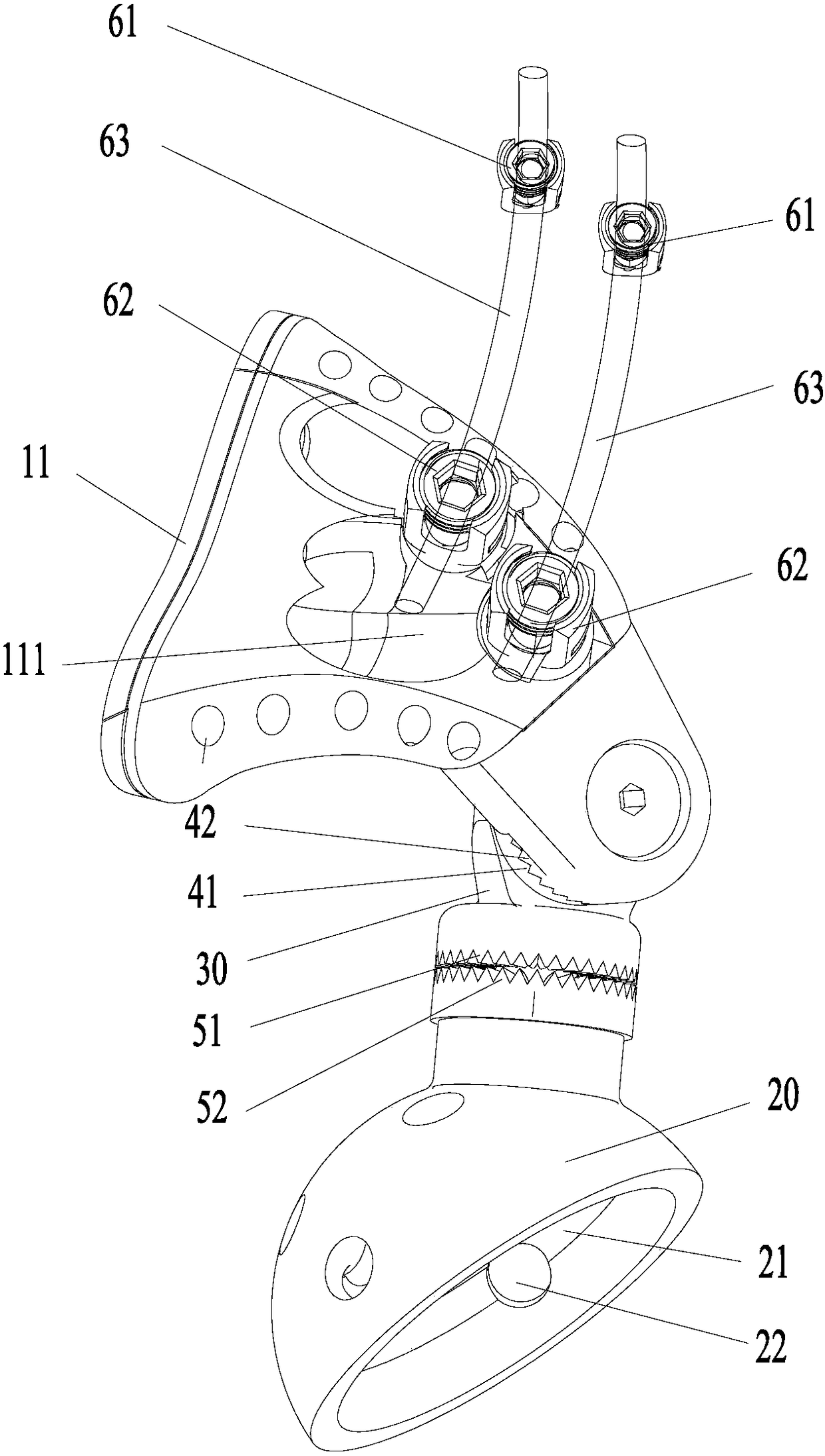 hip prosthesis