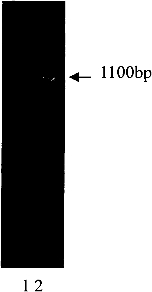 Human apolipoprotein AV monoclonal antibody and application thereof