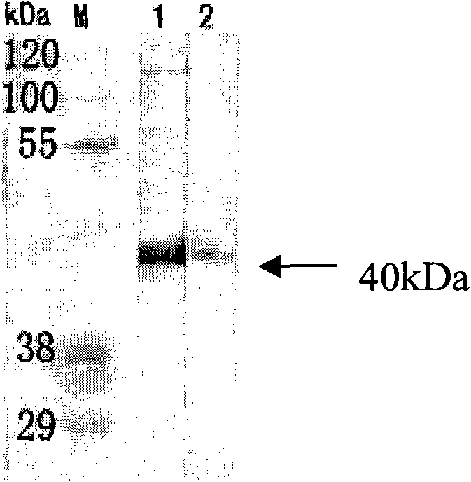 Human apolipoprotein AV monoclonal antibody and application thereof