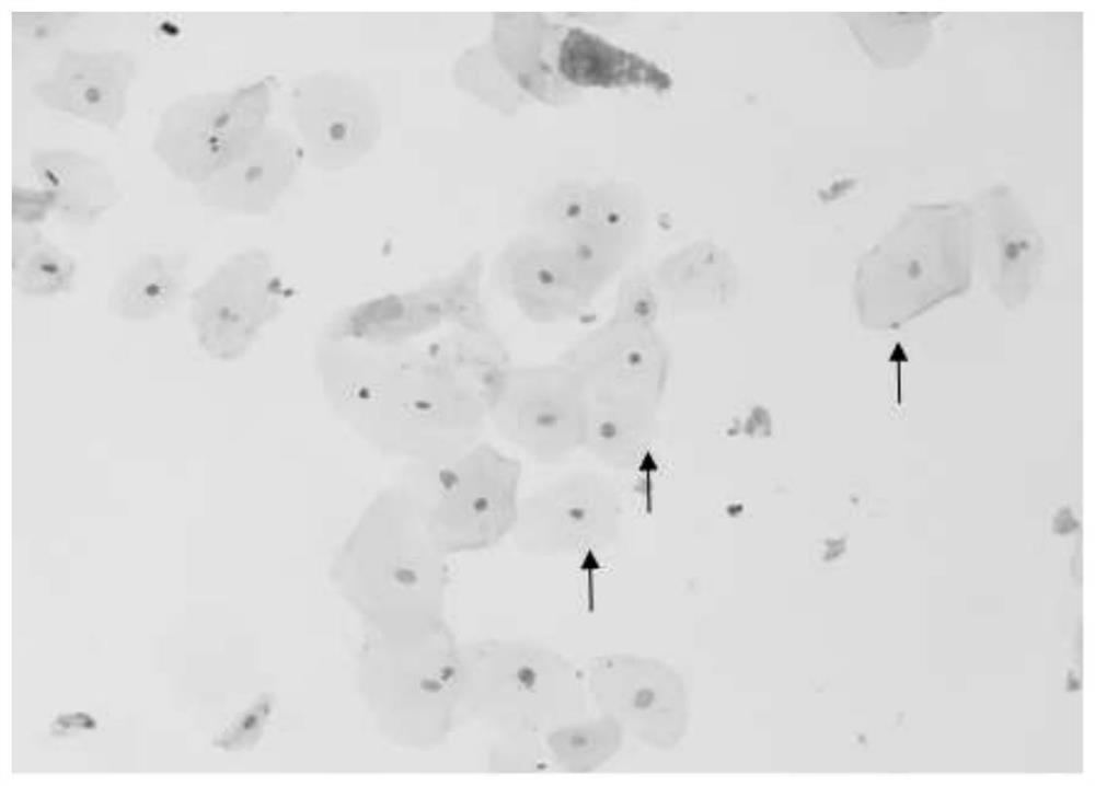 Extraction method of cfdna in sputum specimen