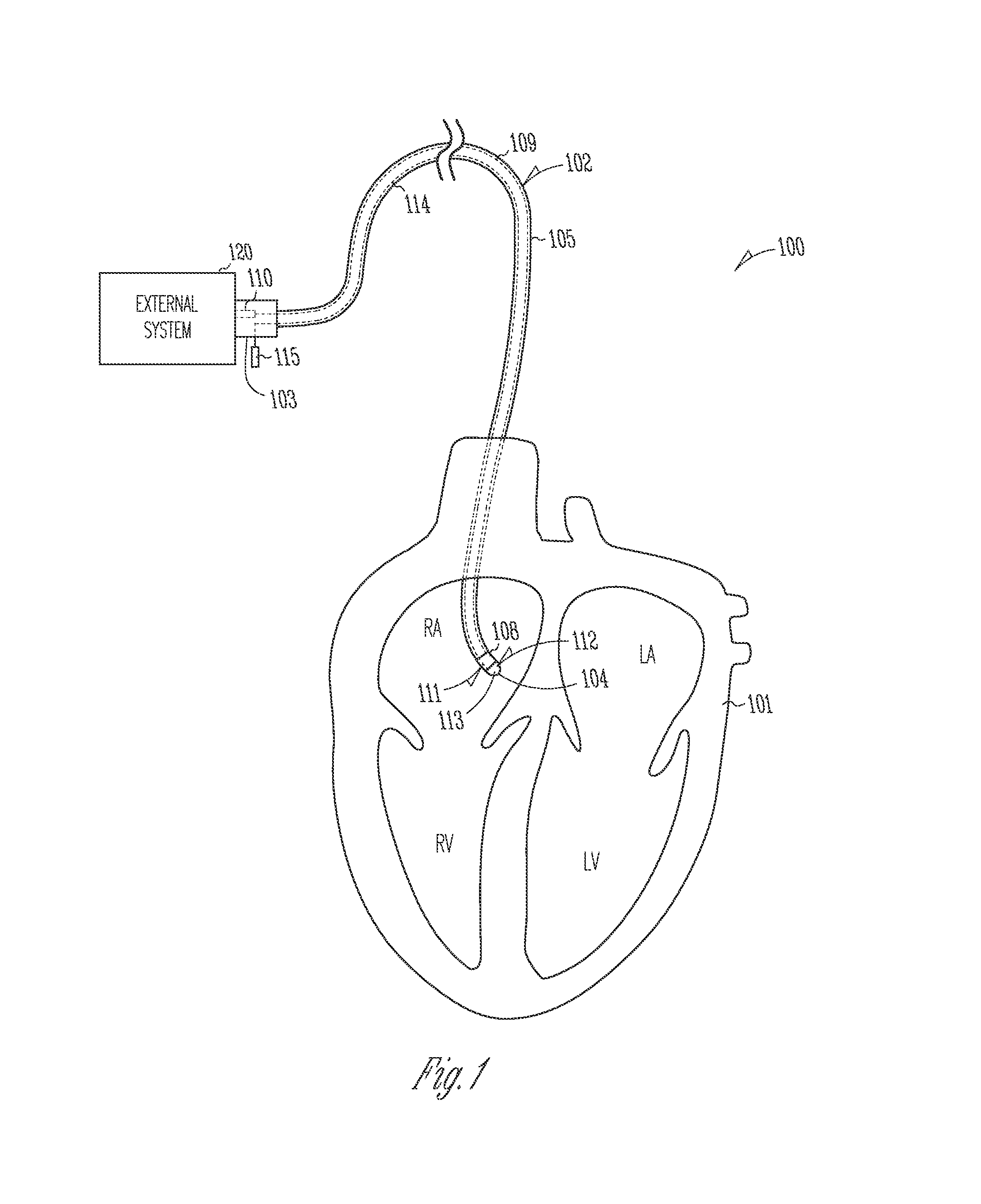 Systems and devices for photoablation