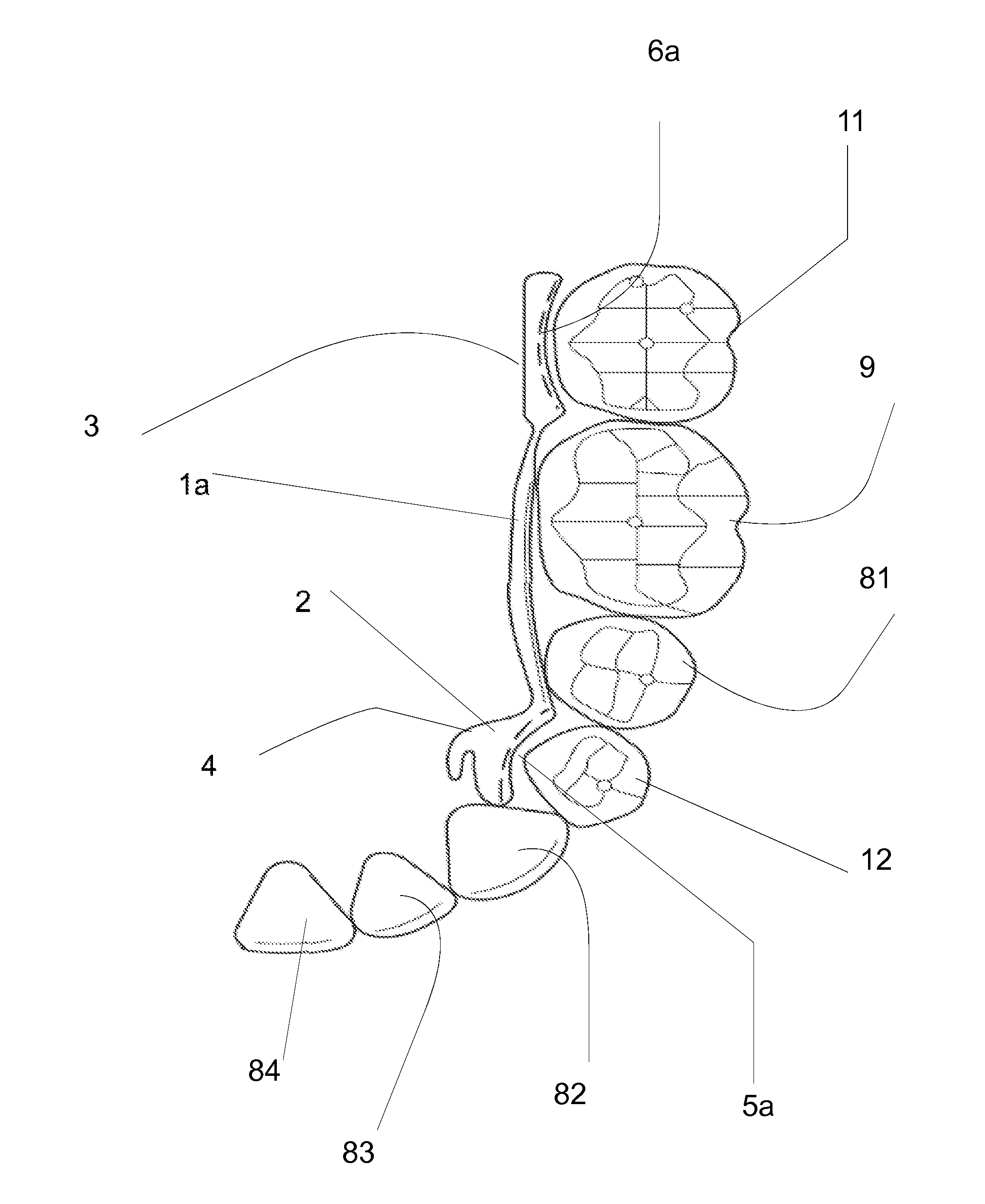 Orthodontic lingual device