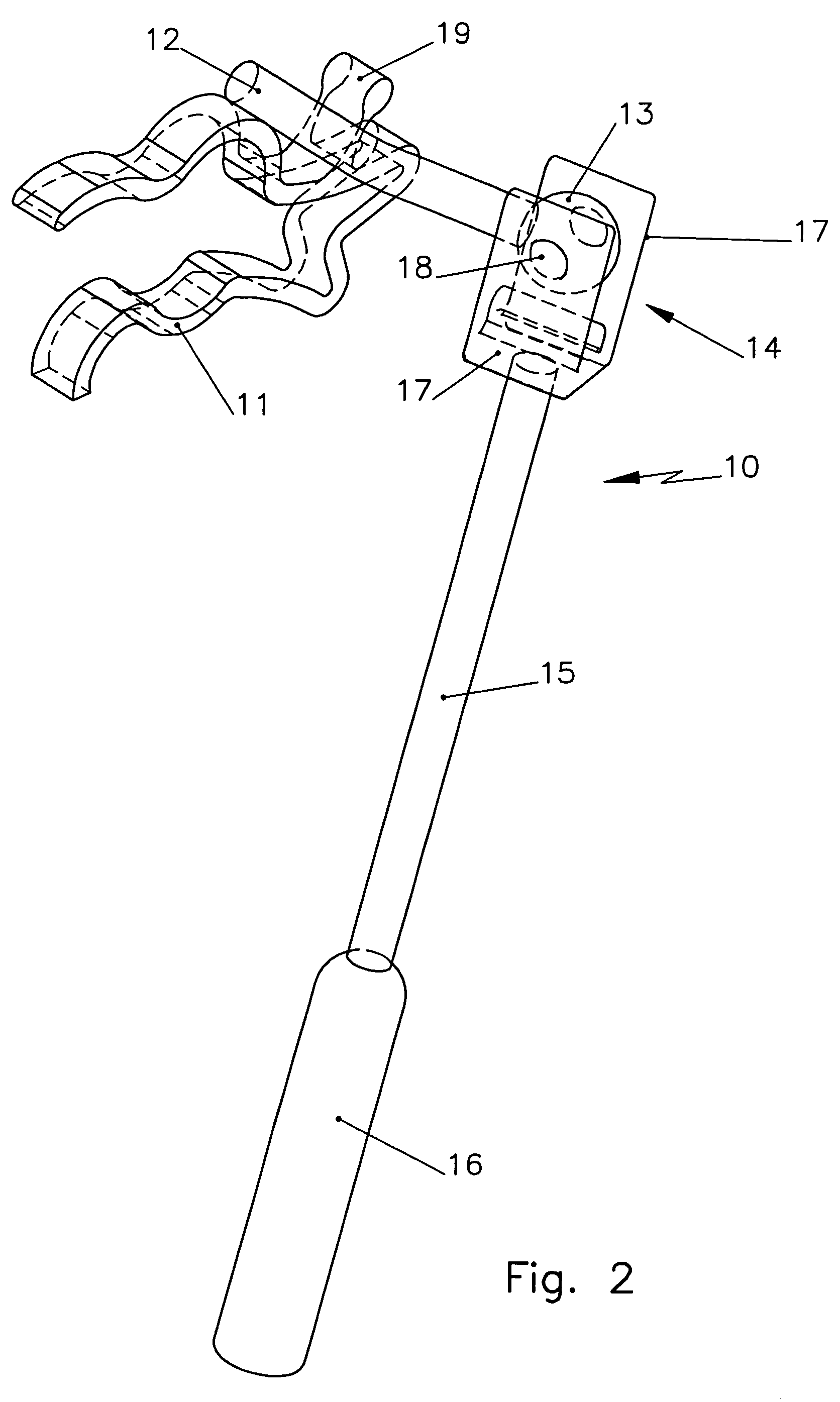 Auditory ossicle prosthesis with tuning option