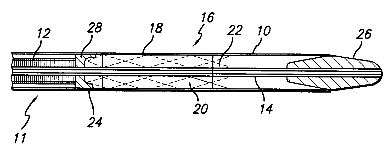 Delivery mechanism for implantable stent