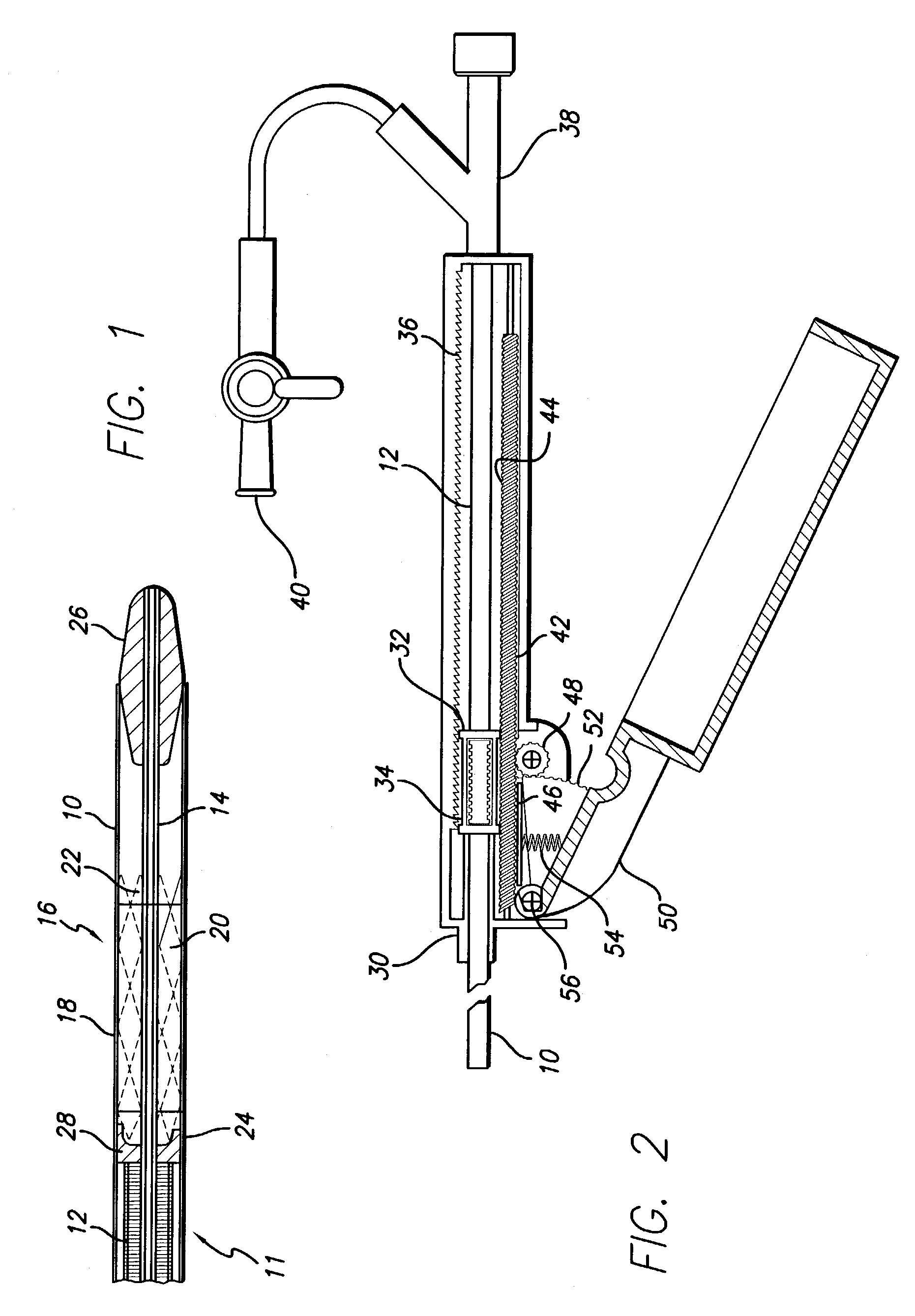 Delivery mechanism for implantable stent