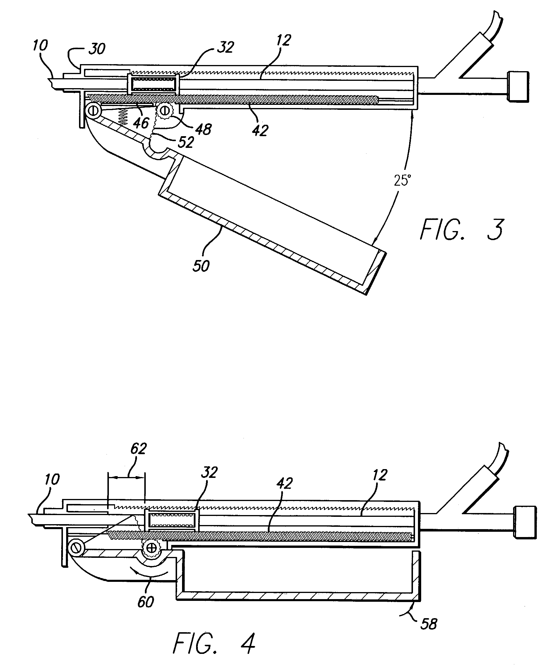 Delivery mechanism for implantable stent