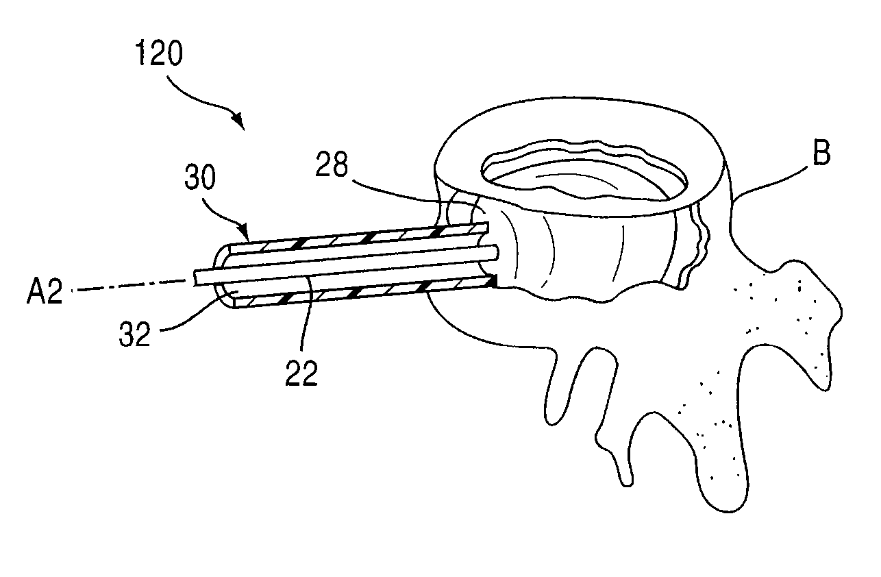 Bone probe apparatus and method of use