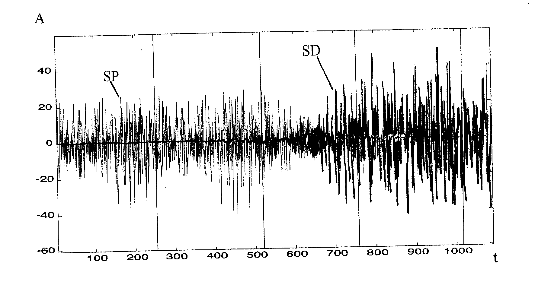 Multicarrier digital signal transmission system using filter banks and memory preloading for initialization