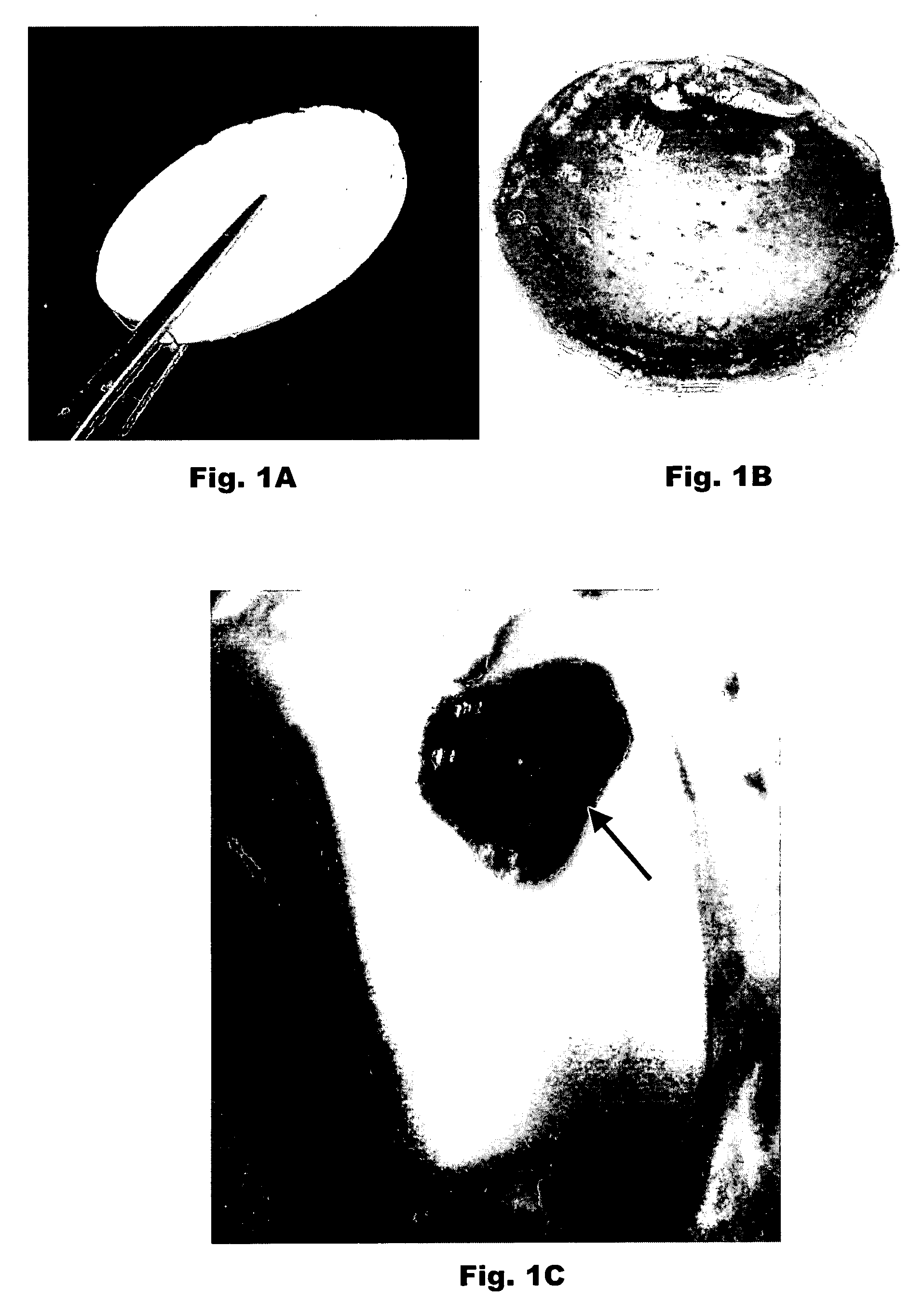 Porous plasma protein matrices and methods for preparation thereof