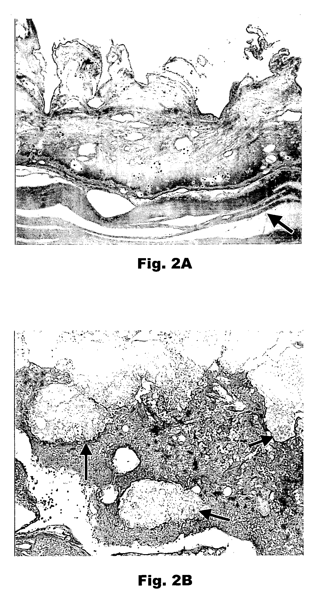 Porous plasma protein matrices and methods for preparation thereof