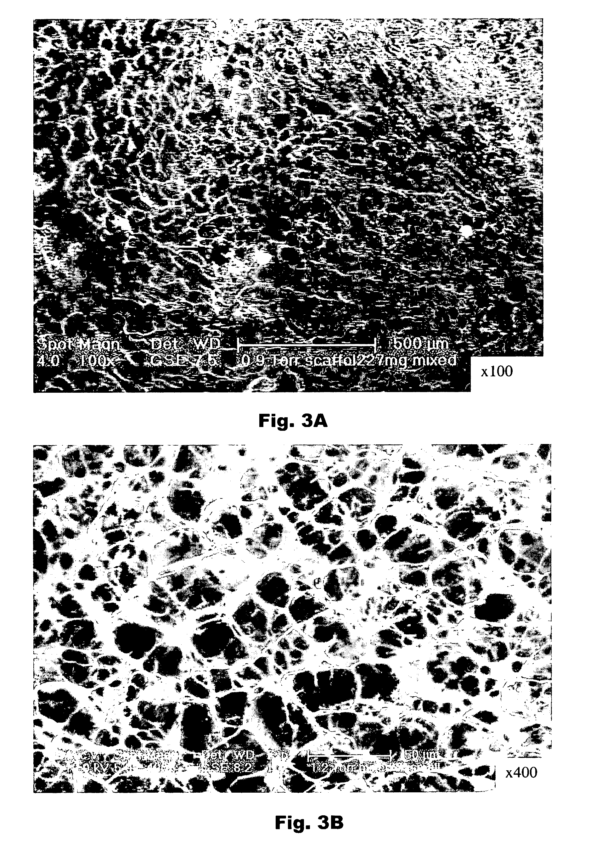 Porous plasma protein matrices and methods for preparation thereof