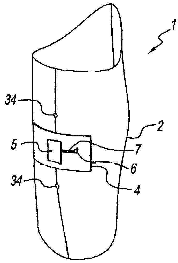 Synergetic Prosthesis